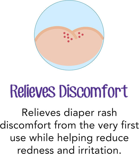 Desitin Daily Defense Baby Diaper Rash Cream with Zinc Oxide to Treat, Relieve & Prevent diaper rash, Hypoallergenic, Dye-, Phthalate- & Paraben-F...