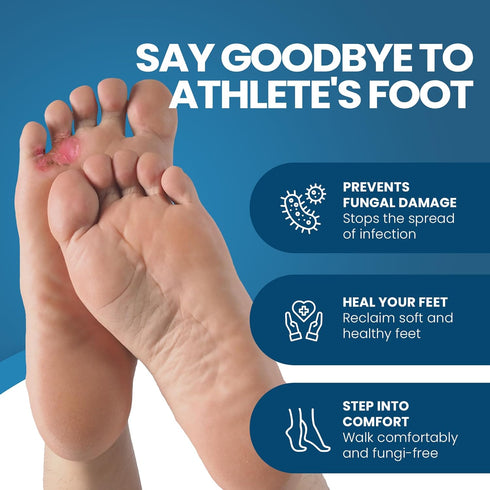 FUNGINIX AF Athletes Foot Cream - Topical Anti-Fungal Treatment, Eliminates Athlete's Foot Infections, Safe & Effective (3 Tubes)...