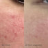 DIME Beauty Mini Super Skin Toner, Alcohol-Free Witch Hazel Toner, Travel-Size Toner with Cucumber Extract, 2 oz / 60 ml...