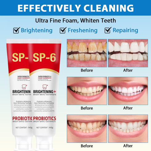 Sp-6 Ultra Whitening, Sp 6 Toothpaste, Ultra Whitening Toothpaste Sp - 6, Probiotic Brightening Toothpaste, Deep Cleaning Care Toothpaste 120g (2P...