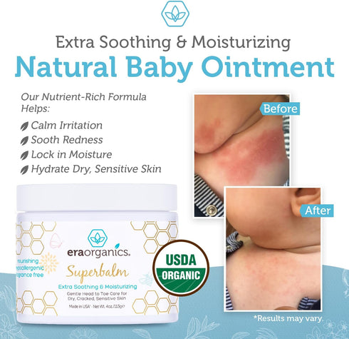 Era Organics Healing Ointment for Babies - USDA Certified Organic Natural Moisturizer Gentle on Sensitive Skin Prone To Baby Eczema, Cradle Cap (I...