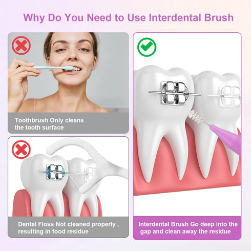 250pcs Interdental Brushes for Braces, 5 Colors Soft Bendable Braces Brushes Dental Teeth Flossing Head Disposable Hygiene Flosser Toothpick Tooth...
