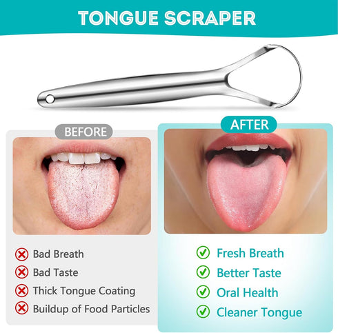 2 Pack Metal Tongue Scraper for Adults, Stainless Steel Tongue Cleaner with Travel Case, Reusable Tongue Scraper for Oral Care...
