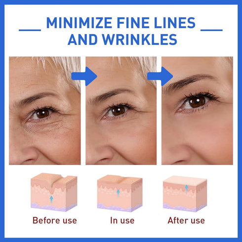 3Pcs Hydrating Facial Skincare Set, With 2 Bot_Ox Hyaluronic-Acid Serum & 1 Guasha-Tool, Anti-Aging Serum For Women, Firm Lift Skin Collagen Boost...