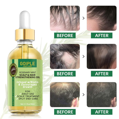 Organic Rosemary Oil For Hair Growth 3.1 FL OZ, Pure Natural Scalp Hair Growth Oil With Essential Oils, Rosemary Hair Oil Nourishing Treatment For...
