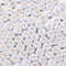 500 Pcs Acrylic Alphabet Letter Beads Rose Gold On White Name Bracelets for Jewelry Making (goldonwhite) (Rosegold)...