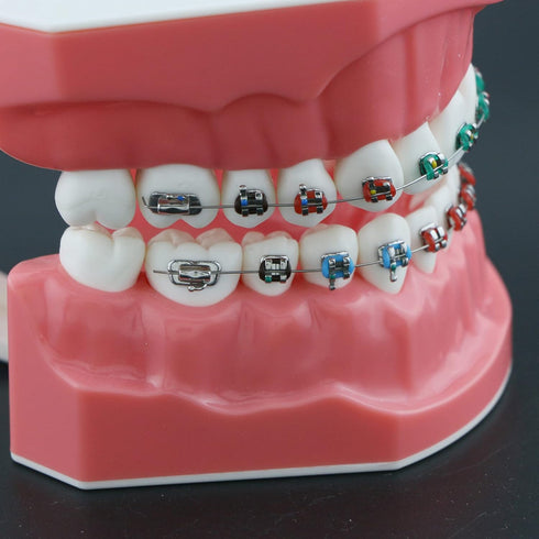 Orthodontic Model Dental Models 1:1 Standard Typodont Teeth Model M7010-2 Demo Teach Study with Archwire Ligature Ties Metal Brackets Buccal Tubes...