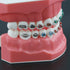 Orthodontic Model Dental Models 1:1 Standard Typodont Teeth Model M7010-2 Demo Teach Study with Archwire Ligature Ties Metal Brackets Buccal Tubes...