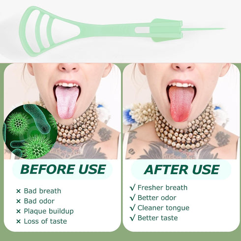 100 Counts Disposable Tongue Scraper with Dental Picks, Plastic Tongue Scrubber,BPA Free Tongue Cleaner Scrapers, Reduce Bad Breath and Fresh Brea...