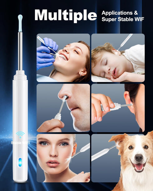 Ear Wax Removal Tool Camera, Ear Cleaner with Camera, Ear Cleaning Kit 1296P HD Ear Scope, 6 LED Lights and 6 Ear Picks, Earwax Removal with Otosc...