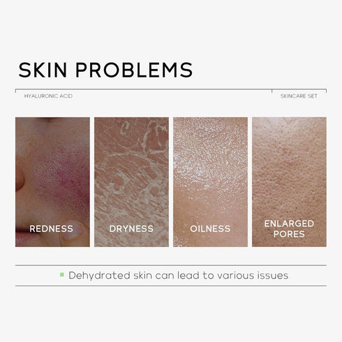 Travel Size Skin Care Set, Hyaluronic Acid Travel Size Skincare Set, Skin Care Routine For Women Girls, Moisturizer, Serum, Eye Cream Hydrated & B...