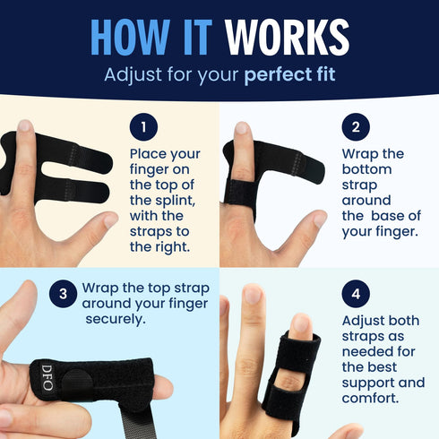 Dr. Frederick's Original Trigger Finger Splint - 2 ct - Mallet Splint & Brace for Arthritis, Injury, & Sprain - Fits Index, Middle, & Ring Fingers...