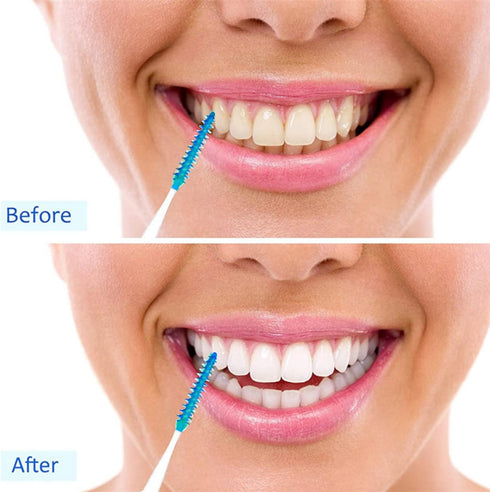 120 Pcs Disposable Interdental Brush Braces Cleaning Brush, Toothpick Dental Tooth Cleaning Tool for Oral Deep Clean Health Care...