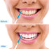 120 Pcs Disposable Interdental Brush Braces Cleaning Brush, Toothpick Dental Tooth Cleaning Tool for Oral Deep Clean Health Care...
