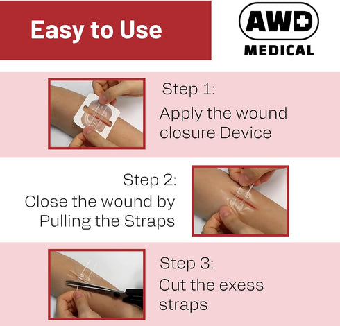 AWD Zip Stitch Wound Closure Strips - 2 Zipstitch Devices, 2 Sterile Gauzes, 2 Alcohol Wipes - Emergency Laceration Device for Cuts Without Stitch...