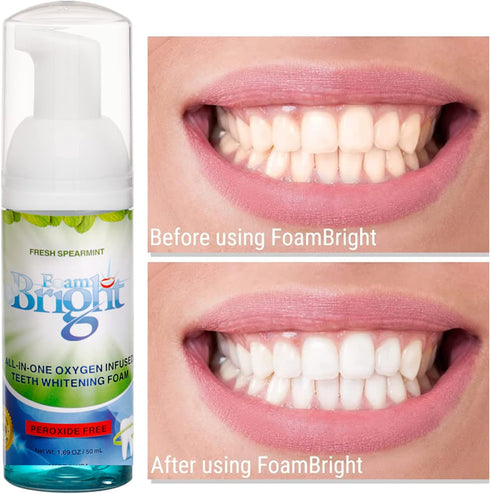 Retainer Cleaner & Aligner Cleaner FoamBright, Great for Invisalign, Teeth Whitening Foam, Candid, Byte, Denture Whitener Toothpaste & Braces Clea...