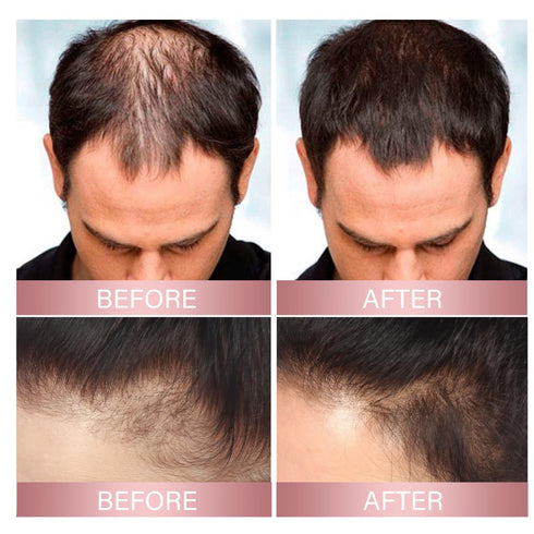 2PCS Hair Helper Spray, Hair Nursing Spray, Rice Water Spray, For Thinning Hair, Hair Thickening Natural Spray...