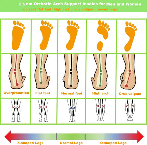 Thin Leather Insoles for Men Arch Support Insoles for Pain Relief Heel Spurs Plantar Fasciitis Orthotic Insoles for Men Thin Shoe Soles with Semi-...