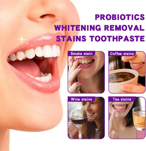 2Pcs SP-6 Ultra Whitening Toothpaste, SP-6 Probiotics Whitening Toothpaste, Fresh Breath, Stain Removing.(Red)...