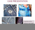 Ouliget Metal Sew On Snap Buttons, Fasteners Press Studs for Sewing Clothes Jeans Overcoat DIY,12mm Dia Snaps,20 Sets,Silver...