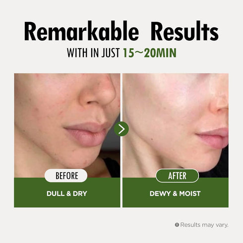 FARMSKIN Superfood Salad Sheet Mask Set of 6 | Face Mask Sheets including MangoSteen, Broccoli, Carrot, Coconut, Blueberry & Tomato | Refreshing, ...