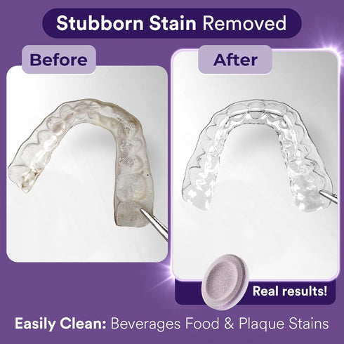 Retainer Cleaner Tablets, Invisalign Cleaner, Remove Stains, Odors & Plaque, Night Guard Cleaner, FSA & HSA Eligible, 4-Months Supply, Denture Cle...