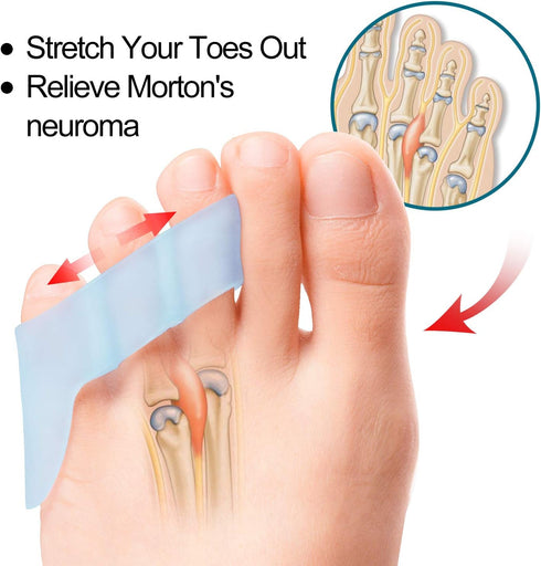 Povihome 10 Pack Pinky Toe Separator and Protectors for Overlapping Toe, Curled Pinky Toes - Spacers for Morton's Neuroma Pain Relief...