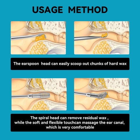 Spiral Ear Wax Remover Ear Cleaning Tool Ear Wax Removal Tool Ear Cleaner Ear Wax Removal kit Spring Ear Wax Cleaner Tool Set...