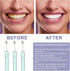 Ultrasonic Electronic Toothbrush with 6 Modes and Smart Timer - Perfect for Men and Women - Clean Teeth and Gums Effectively, Geen...