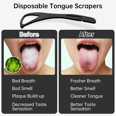 36 Counts Tongue Scrapers with Dental Picks, BPA Free Tongue Cleaner Scrapers for Adults & Kids, Plastic Tongue Scrubber with Zipper Bag Great for...