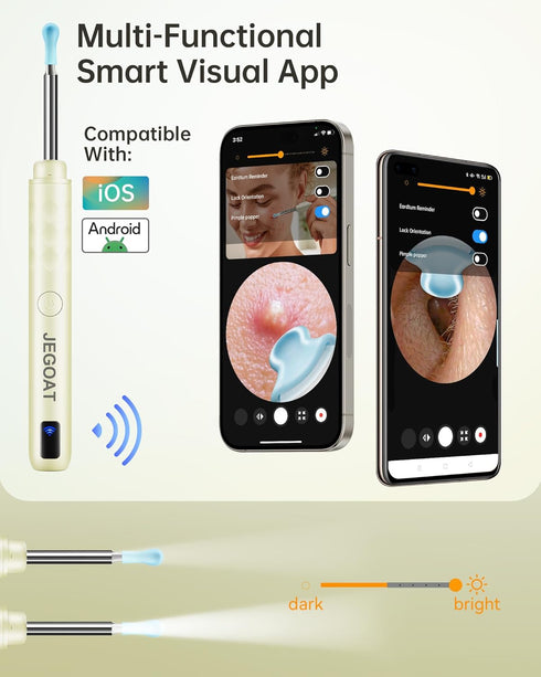 Ear Wax Removal Tool Camera, Ear Cleaner with Camera, Ear Cleaning Kit 1296P HD Ear Scope and 6 LED Lights, 10 Ear Pick Tips, Earwax Removal kit w...