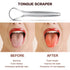 AILE Tongue Scraper, 100% Useful Surgical Stainless Steel Tongue Cleaner for Both Adults and Kids, Professional Reduce Bad Breath Metal Tongue Scr...