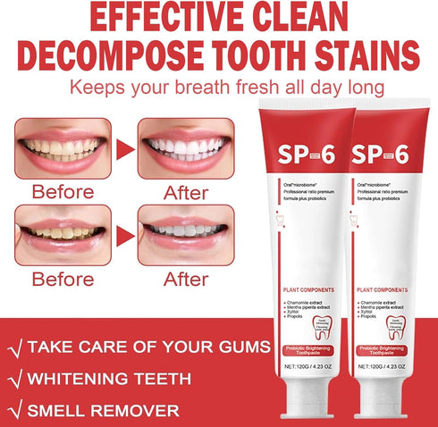 Sp-6 Ultra Whitening Toothpaste, Upgrade - 2PCS Sp6 Probiotic Brightening Toothpaste, Fresh Breath, Deep Cleaning & Care 120g...