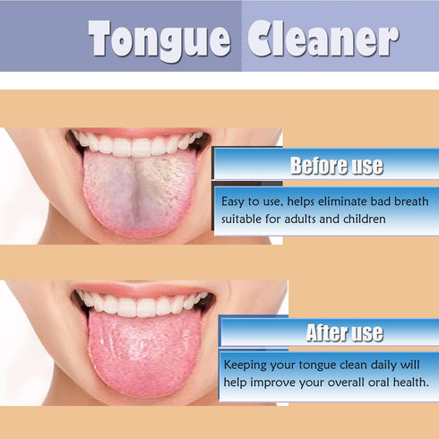 AKOAK 3 Pcs Tongue Scraper Cleaner, Tongue Cleaning Board to Help Eliminate Bad Breath, Reduce Bad Breath, for Adults and Children, Professional O...