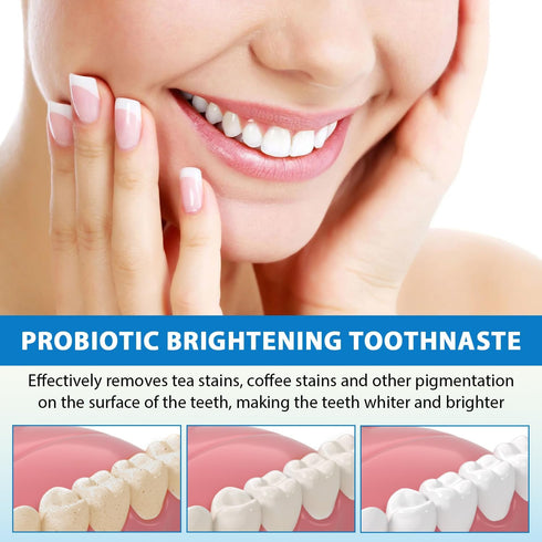 Sp-6 Ultra Whitening, Sp 6 Toothpaste, Ultra Whitening Toothpaste Sp - 6, Probiotic Brightening Toothpaste, Deep Cleaning Care Toothpaste 120g (2P...