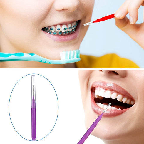Braces Brush,Interdental Brush Toothpick, Dental Tooth Flossing Head, Oral Dental Hygiene Flosser,Toothpick Cleaners, Tooth Cleaning Tools(7Colors...