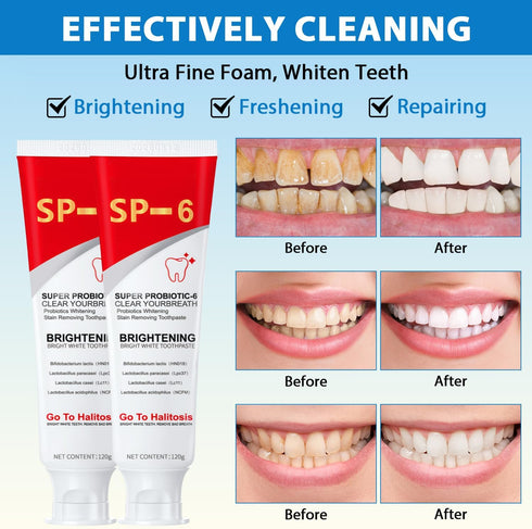 Sp-6 Ultra Whitening Toothpaste, Super Probiotic SP-6 Toothpaste, Probiotic Brightening Toothpaste, Deep Cleaning Care Toothpaste (2PCS)...