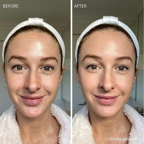 MCoBeauty Miracle BB Cream - Perfects And Corrects Skin - Covers Imperfections - Lightweight And Buildable Coverage - Delivers Extra Hydration - F...