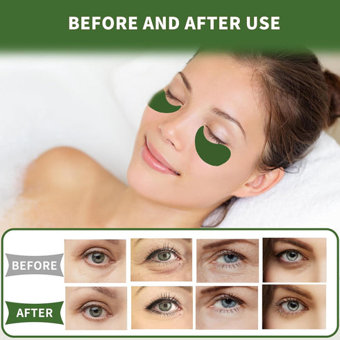 Under Eye Patches 70PCS, Green Tea Eye Patches for Puffy Eyes Treatment, Under Eye Masks for Dark Circles and Puffiness, Non-Irritating Eye Mask S...