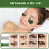 Under Eye Patches 70PCS, Green Tea Eye Patches for Puffy Eyes Treatment, Under Eye Masks for Dark Circles and Puffiness, Non-Irritating Eye Mask S...