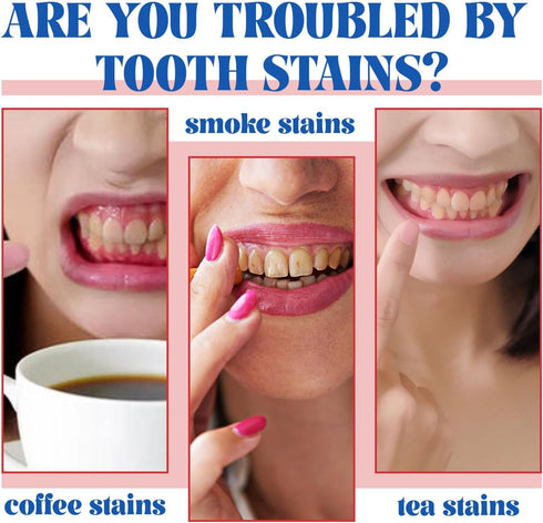 2 Pcs SP-6 Brightening Probiotic Toothpaste,Deep Cleaning Care Fresh Breath SP-6 Ultra Whitening Toothpaste....