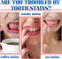 2 Pcs SP-6 Ultra Whitening,Deep Cleaning Care Fresh Breath SP-6 Probiotic Ultra Whitening Toothpaste. (Red and Blue style)...