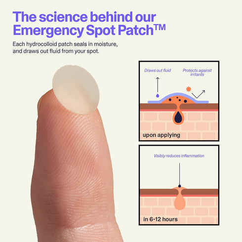 Curology Emergency Spot Pimple Patches for Face, Hydrocolloid Pimple Patches Fast-Acting Support, Spot Concealing and Oil Absorbing, 40 Count...
