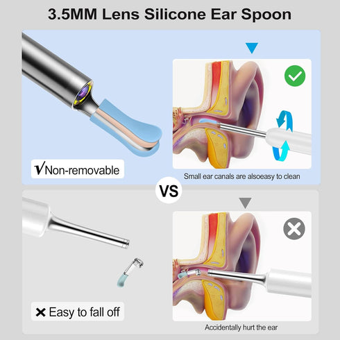 Ear Wax Removal, Ear Cleaner with Camera with 1080P, Ear Wax Removal Tool with 6 LED Light, Ear Wax Removal Kit with 8 Ear Pick, Ear Camera for iP...