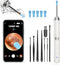 Ear Wax Removal, Ear Cleaner with Camera and Light, Ear Wax Removal Kit with 1296P Otoscope, Ear Cleaning Tool with 6 Ear Spoon, Ear Camera for iP...