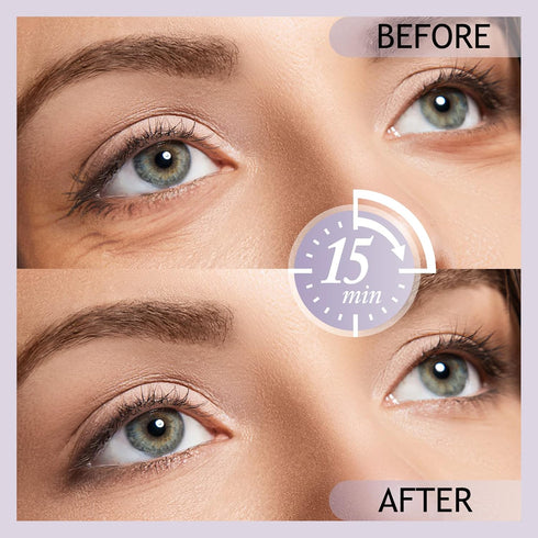 SHVYOG Under Eye Patches (20 Pairs), Under Eye Mask for Dark Circles and Puffiness, Eye Gel Pads for Puffy Eyes, Anti Aging Eye Bags Treatment for...