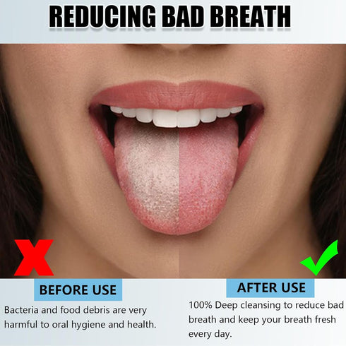 5 Pcs Tongue Scraper Tongue Brush, Scraper Handle Tongue Cleaners Brush to Help Resist Bad Breath and Freshen The Breath, Great for Adult Kids Rem...