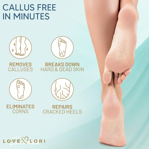 Callus Remover for Feet (Extra Strength) Foot Callus Remover Gel - Feet Scrubber, Pedicure Spa Tools, 6oz...