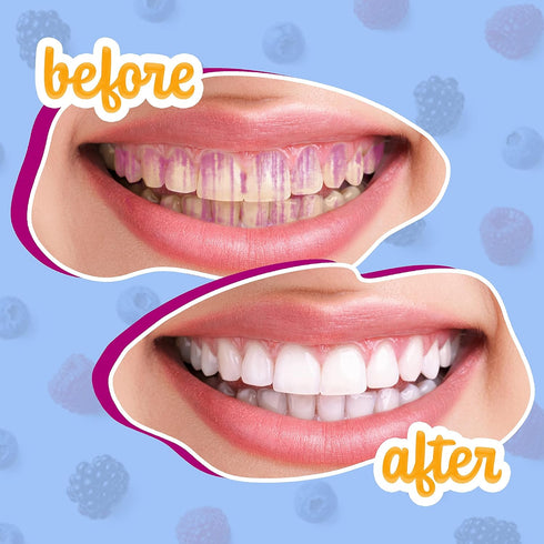 Lingito Plaque/Dental Disclosing Tablets, A Teeth Coloring Tablets Plaque Finder Solution to Effectively Remove Plaque and Tartar Buildup, Improve...