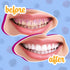 Lingito Plaque/Dental Disclosing Tablets, A Teeth Coloring Tablets Plaque Finder Solution to Effectively Remove Plaque and Tartar Buildup, Improve...